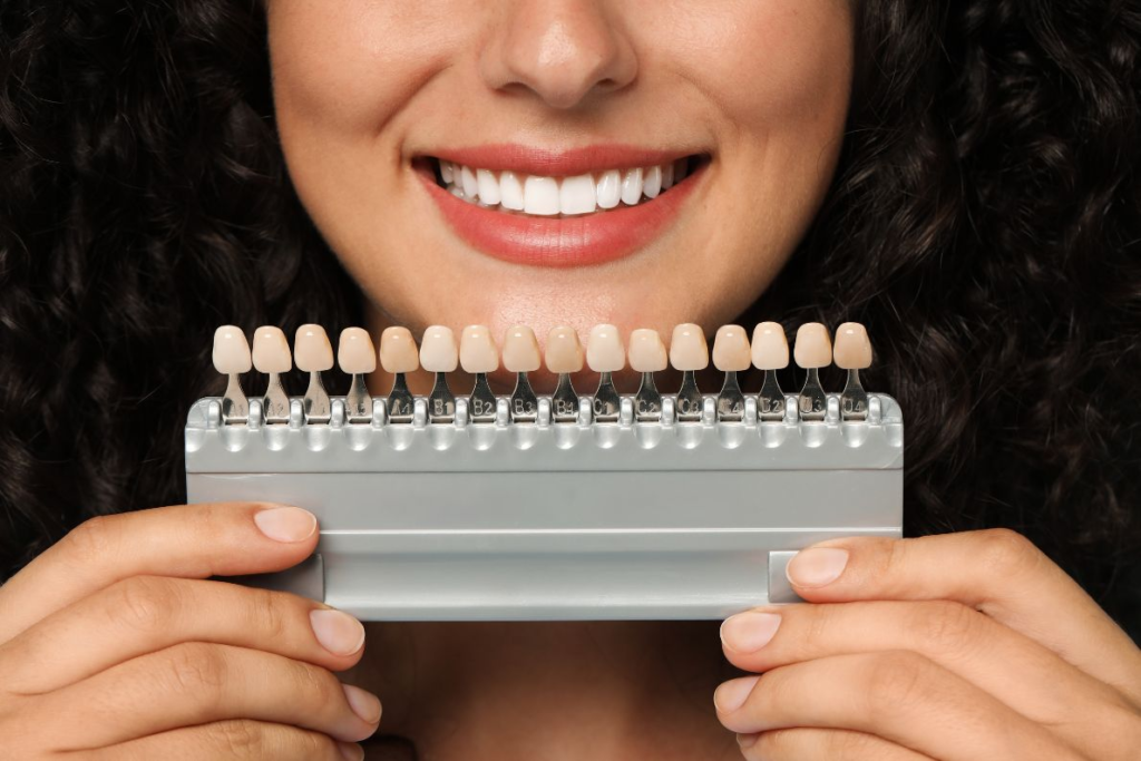 Benefits of Choosing Cosmetic Veneers for Smile Enhancement