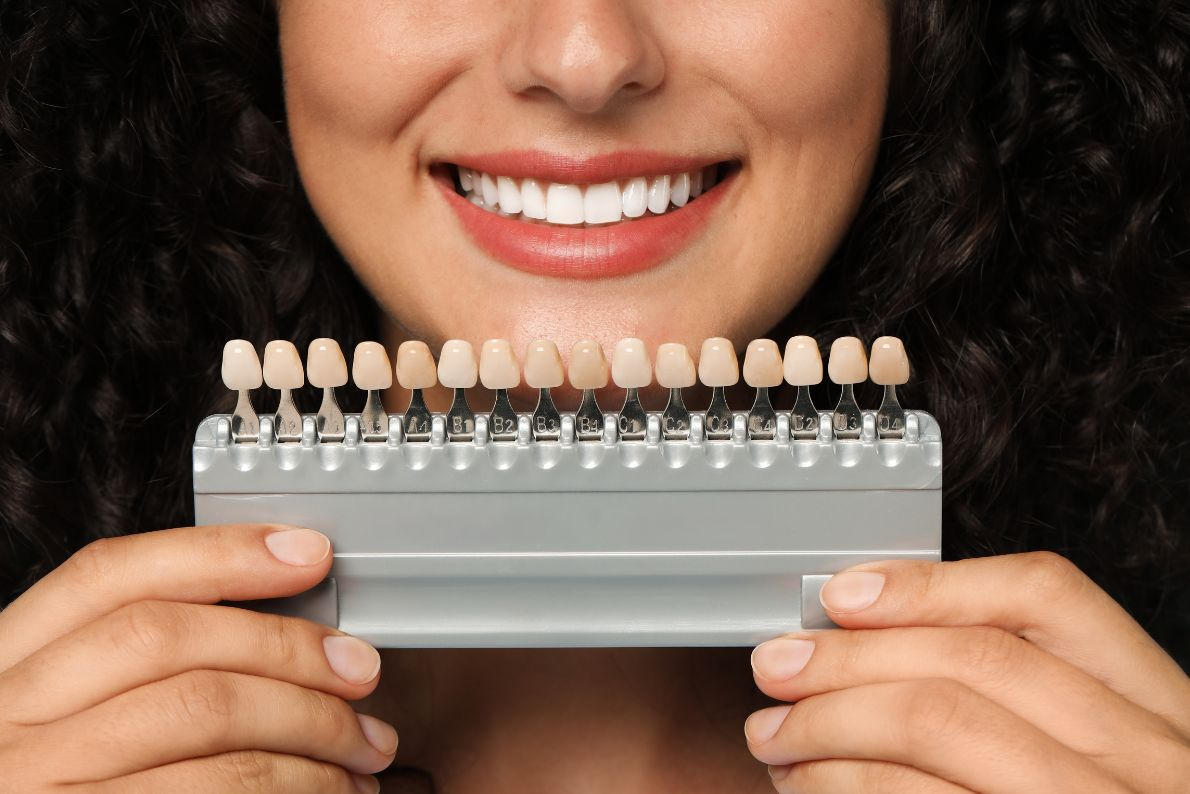 Benefits of Choosing Cosmetic Veneers for Smile Enhancement